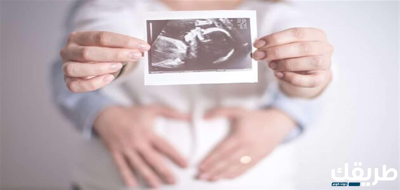توسع حوض الكلى عند الجنين في الشهر الثامن  4 612294789971324